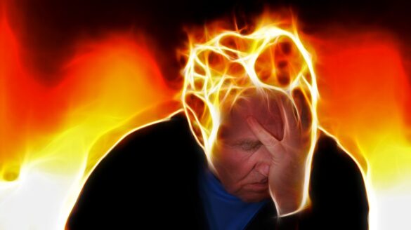Homem com uma de suas mãos no rosto junto de uma ilustração de labaredas de fogo saindo de sua cabeça, e exemplificando figurativamente como é a síndrome de burnout